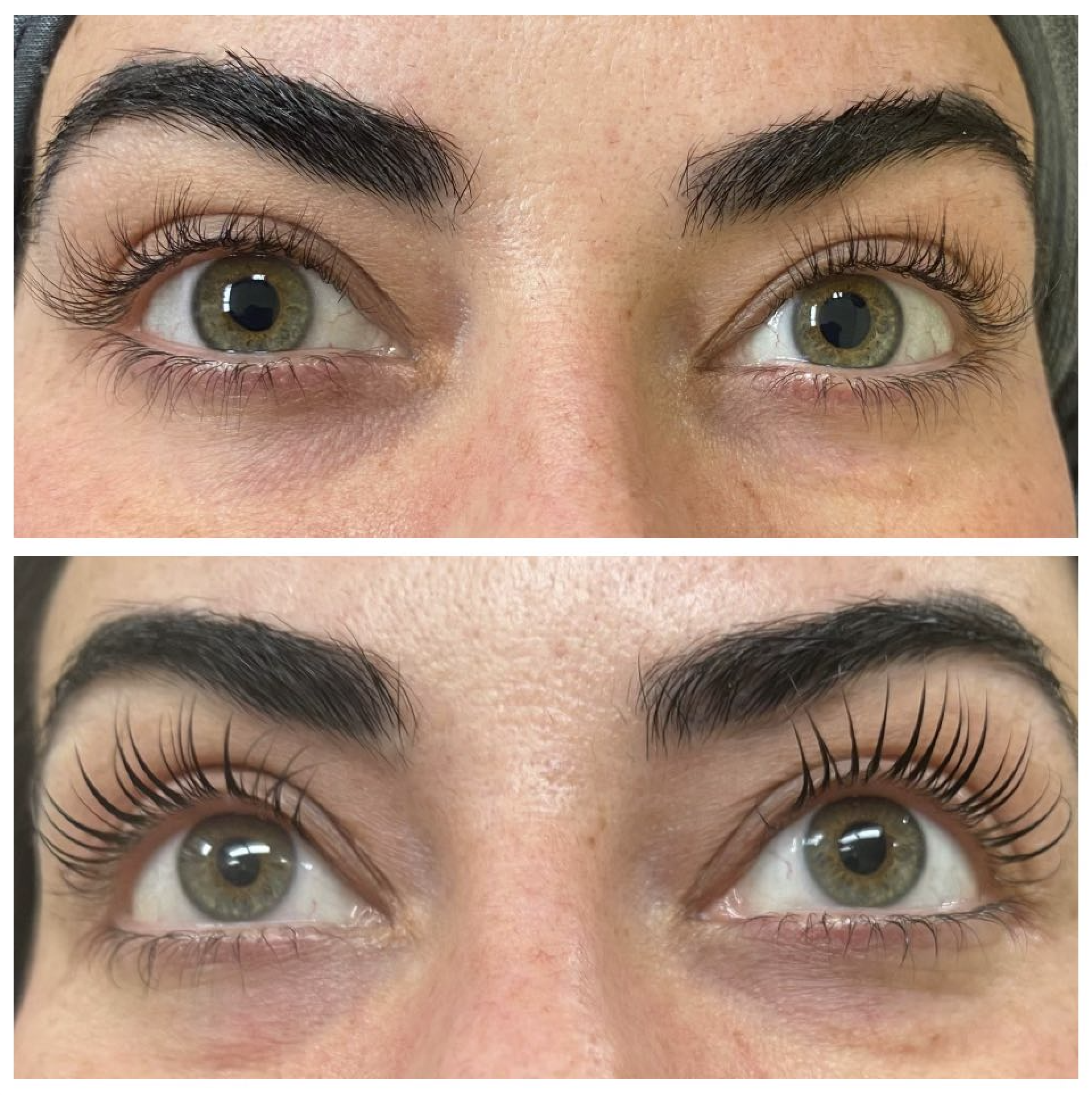 Before and After